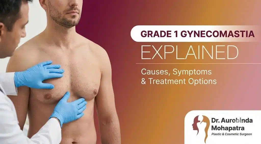 Grade 1 gynecomastia causes symptoms and treatment options